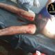 PJC: Hieren con cuchillo a un hombre en San Juan Neuman