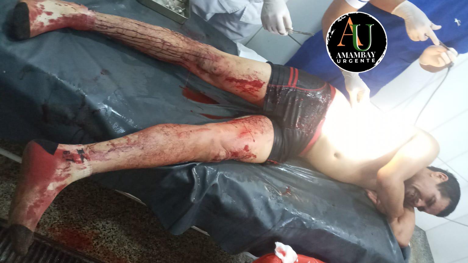 PJC: Hieren con cuchillo a un hombre en San Juan Neuman PJC: Hieren con cuchillo a un hombre en San Juan Neuman