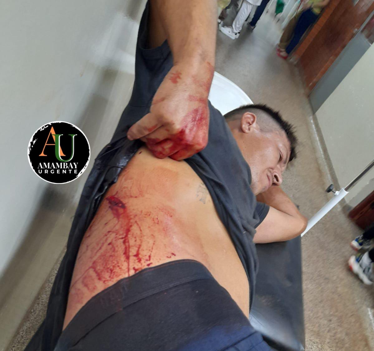 PJC: Pelea entre adictos dejó un herido por arma blanca en el barrio Mariscal Estigarribia PJC: Pelea entre adictos dejó un herido por arma blanca en el barrio Mariscal Estigarribia