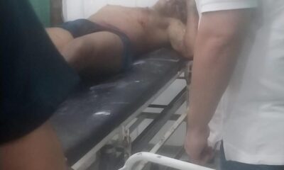 Venezolano fue herido con cuchillo en un local gastronómico