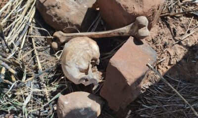 Hallan cráneo humano y restos óseos en propiedad rural de Amambay
