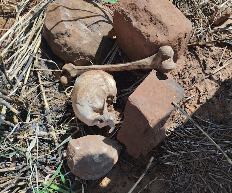 Hallan cráneo humano y restos óseos en propiedad rural de Amambay Hallan cráneo humano y restos óseos en propiedad rural de Amambay