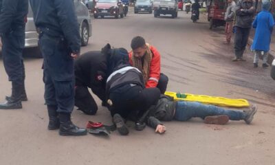 PJC: Motociclista quedó con fractura tras chocar contra un automóvil
