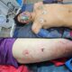 PJC: Golpean e hieren con arma blanca a un joven de 19 años