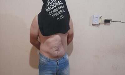 PJC: Joven denunció a su concubino por agredirla físicamente