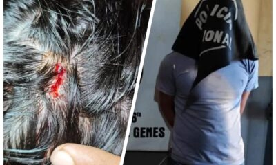 PJC: Hombre golpeó a su hermana en la cabeza con una botella