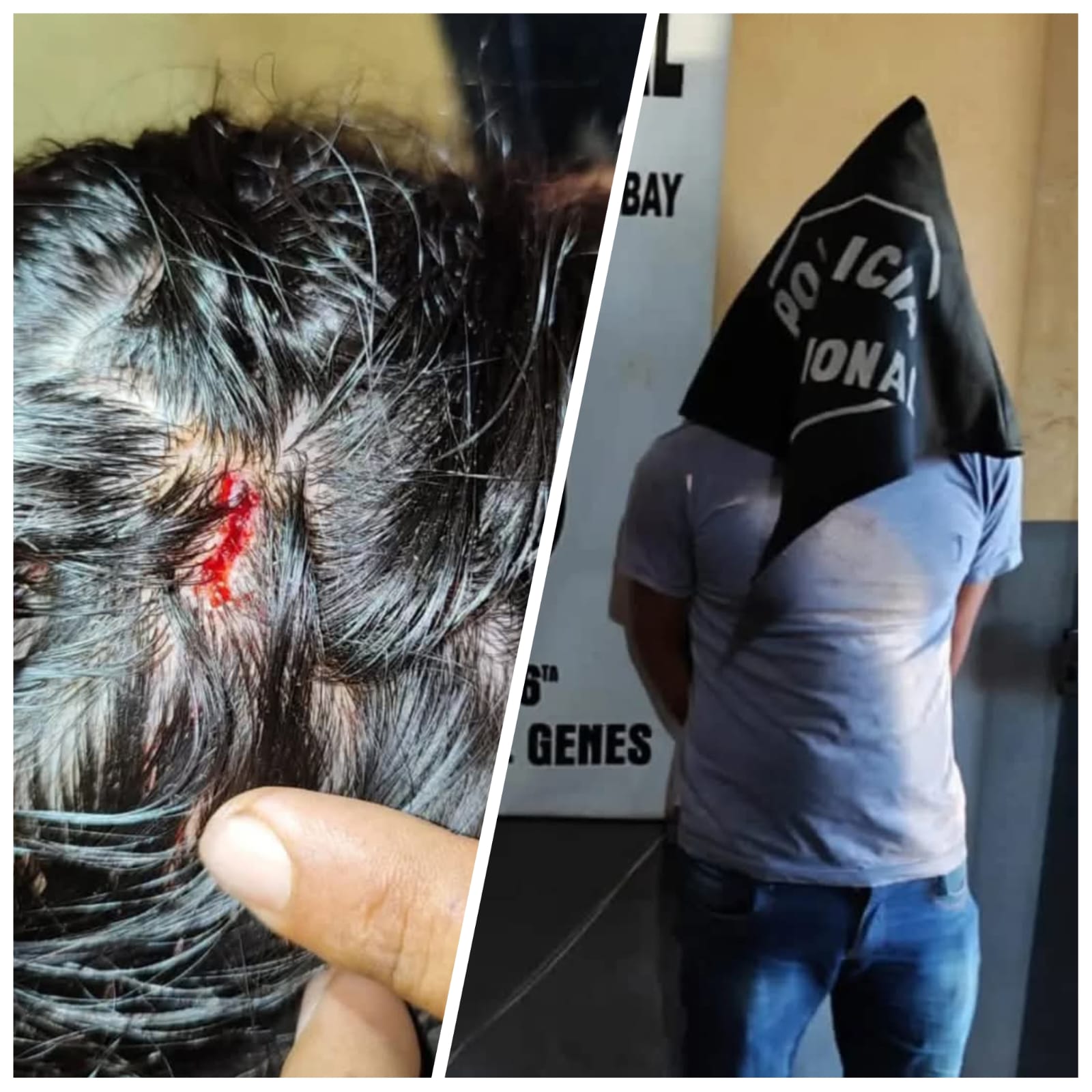 PJC: Hombre golpeó a su hermana en la cabeza con una botella PJC: Hombre golpeó a su hermana en la cabeza con una botella
