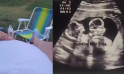¿Robo de bebés o embarazo psicológico?: Clínicas confirma que joven no llegó embarazada