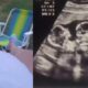 ¿Robo de bebés o embarazo psicológico?: Clínicas confirma que joven no llegó embarazada