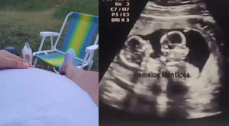 ¿Robo de bebés o embarazo psicológico?: Clínicas confirma que joven no llegó embarazada