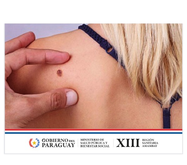 Salud: Cuidado de la piel en verano: protección y prevención crucial Salud: Cuidado de la piel en verano: protección y prevención crucial