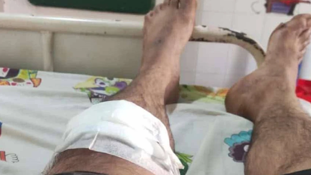 Un hombre ataca a su hermano con un machete en San Pedro