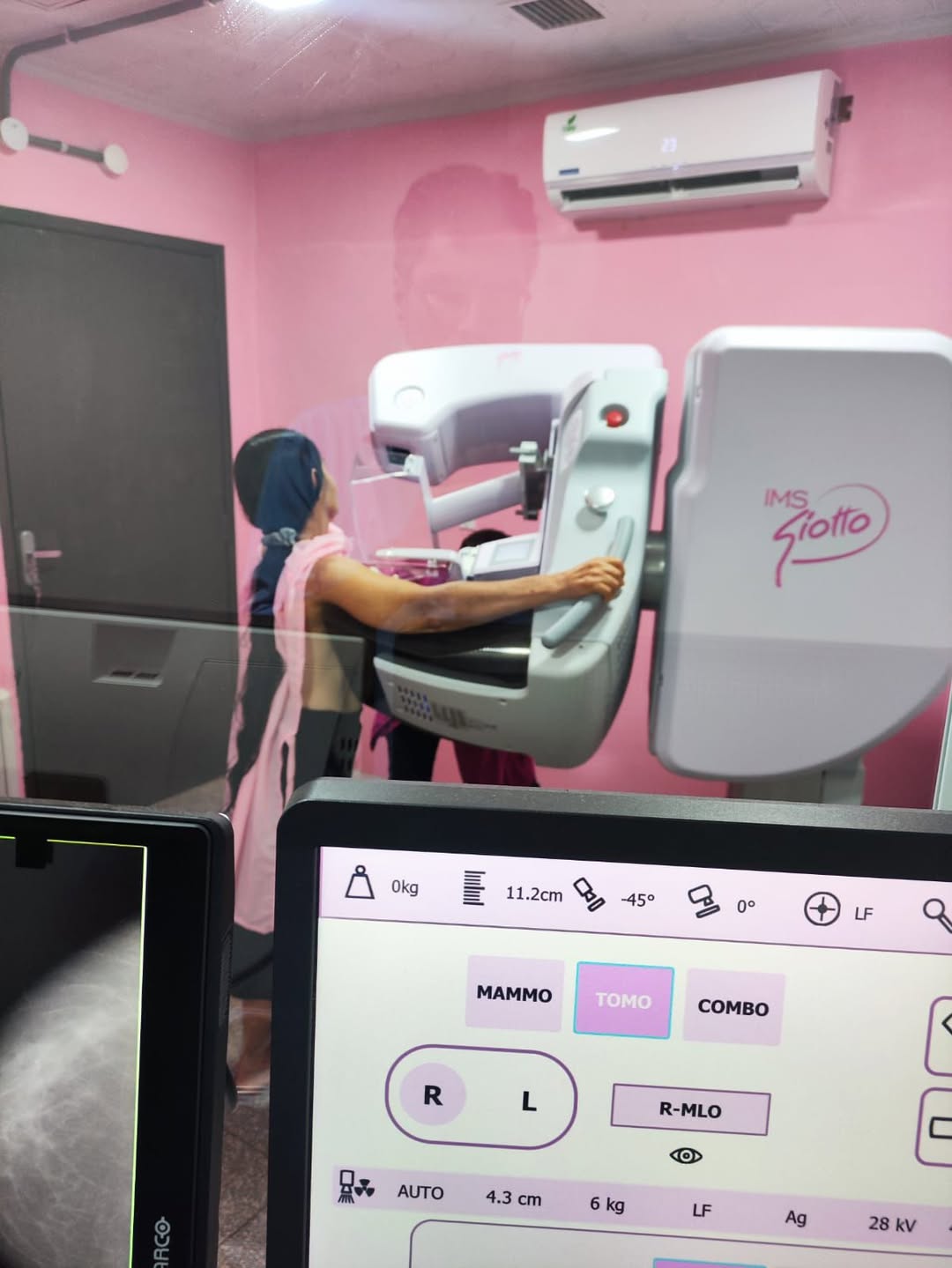 Salud: Profesionales del Hospital Regional se capacitan en tecnología avanzada para diagnóstico de cáncer de mama Salud: Profesionales del Hospital Regional se capacitan en tecnología avanzada para diagnóstico de cáncer de mama