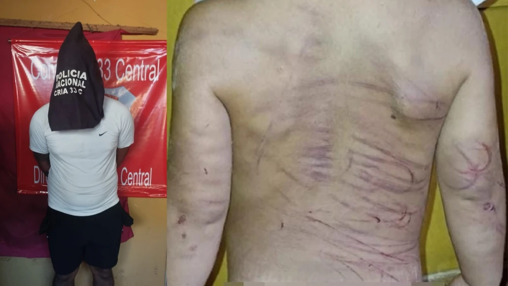 Hombre es detenido por agredir a golpes a su pareja y con cable y cinto a hijastro de 3 años