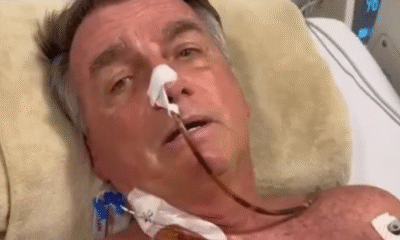 Jair Bolsonaro es intervenido quirúrgicamente por problemas intestinales